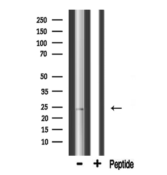 MRPL13 Antibody