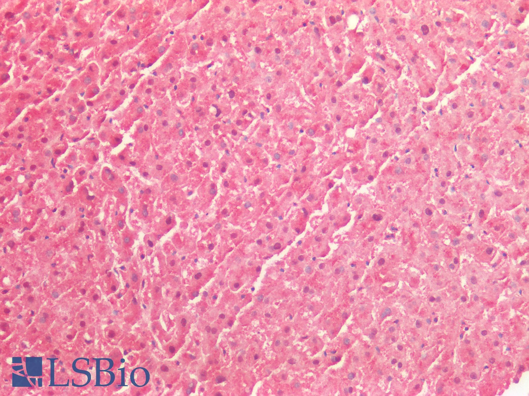 IHC-plus™ Polyclonal Rabbit anti-Human ICAM-1 / CD54 Antibody (IHC)