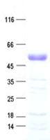 Human PBX4 Protein (Recombinant His, N-Terminal)