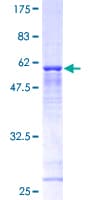 Human TBCB / CKAP1 Protein (Recombinant GST)