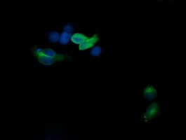 CD1C Antibody (clone OTI2B3)