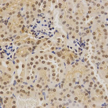 Polyclonal Rabbit anti-Human BMI1 / PCGF4 Antibody (IHC, IF, WB)