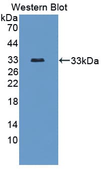 VRL1 / TRPV2 Antibody (aa1-264)