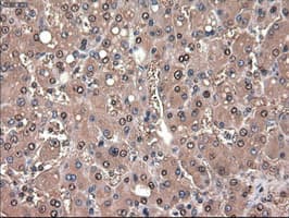 PTCH1 / Patched 1 Antibody (clone OTI5C7)
