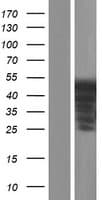 ER81 / ETV1 Protein (Over-Expression Lysate Myc-DDK (Flag))