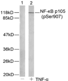 NFKB1 / NF-Kappa-B Antibody