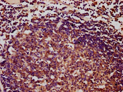 IBA57 / C1orf69 Antibody