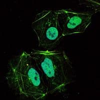 OPG / Osteoprotegerin Antibody (clone 5G2)