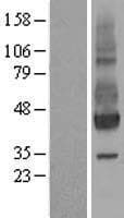 NPTN / SDR1 Protein (Over-Expression Lysate Myc-DDK (Flag))