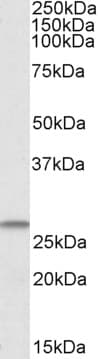 IHC-plus™ Polyclonal Goat anti-Human CHCHD3 Antibody (aa173-185, IHC, WB)