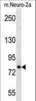 IHC-plus™ PRKCA / PKC-Alpha Antibody (aa1-30)