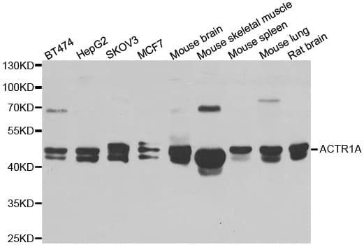 Polyclonal Rabbit anti-Human ACTR1A / Centractin Antibody (IHC, WB)