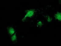 CAT / Catalase Antibody (clone OTI3C3)