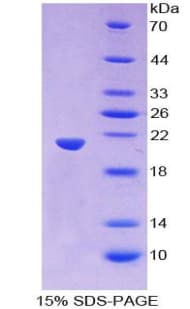 Human WNT11 Protein (Recombinant 6His, N-terminus)