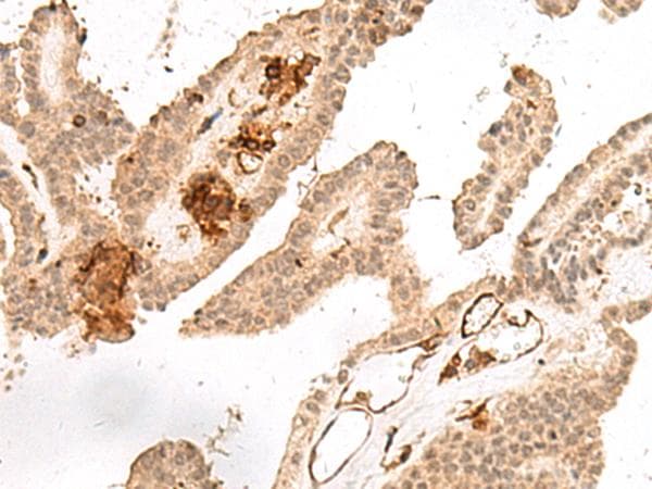 GRASP Antibody