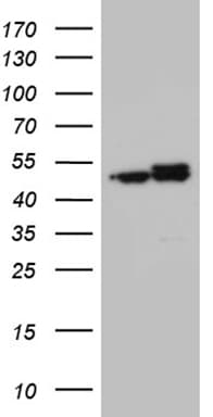 HNRNPH1 / hnRNP H Antibody (clone OTI5D11)