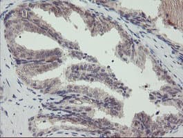 Monoclonal Mouse anti-Human DPH2 Antibody (clone OTI1A12, IHC, WB)