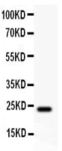 CLDN5 / Claudin 5 Antibody (aa191-218)