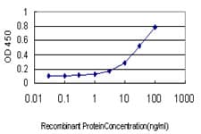 Monoclonal Mouse anti-Human TRIM36 Antibody (clone 2D11, IHC, IF, WB)