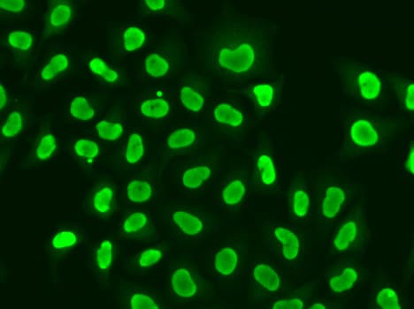 XRCC5 / Ku80 Antibody