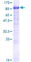 Human AHNAK2 Protein (Recombinant GST)