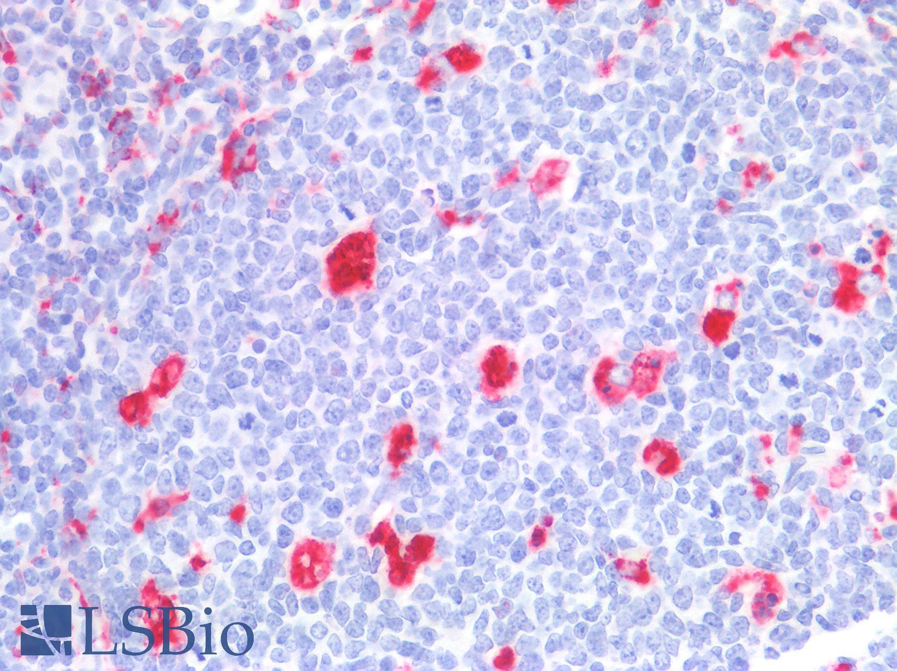 PathPlus™ CD68 Antibody (clone KP-1)