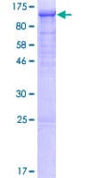 Human GCK / Germinal Center Kinase Protein (Recombinant GST)