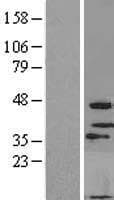 Human MOGAT3 Protein (Over-Expression Lysate Myc-DDK (Flag))
