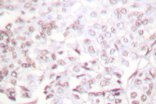 Polyclonal Rabbit anti-Human XRCC2 Antibody (Phe240, IHC, WB)
