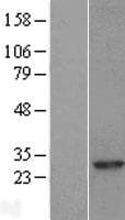 RAB8A / RAB8 Protein (Over-Expression Lysate Myc-DDK (Flag))