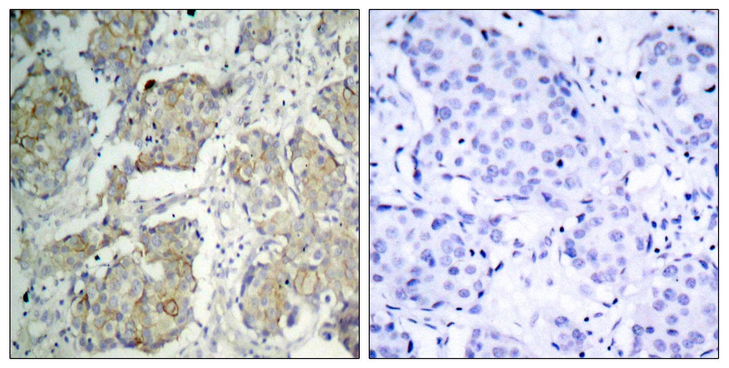 KDR / VEGFR2 / FLK1 Antibody (phospho-Tyr1214)