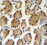 FAT10 / UBD Antibody (aa120-153)