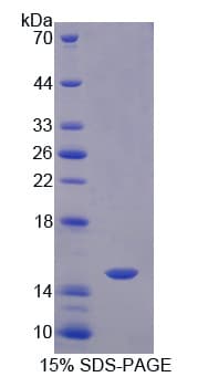 Human CASP8 / Caspase 8 Protein (Recombinant His-T7)
