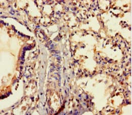 Polyclonal Rabbit anti-Human MRAP2 Antibody (WB)