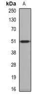 Polyclonal Rabbit anti-Human PPOX Antibody (IHC, IF, WB)