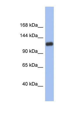 Polyclonal Rabbit anti-Human HIF1A / HIF1 Alpha Antibody (aa755-804, WB)