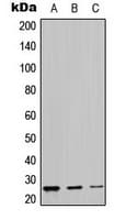 LYPLA1 Antibody (Internal)