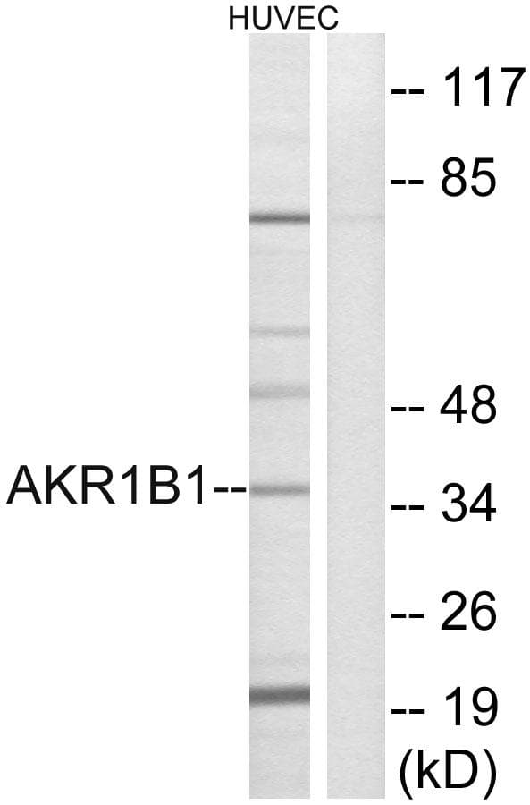AKR1B1 / Aldose Reductase Antibody