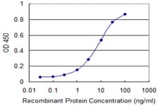 SCP2 / SCPX Antibody (clone 2E9-1B3)