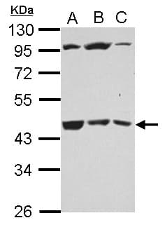 GALT4 / B3GALT4 Antibody