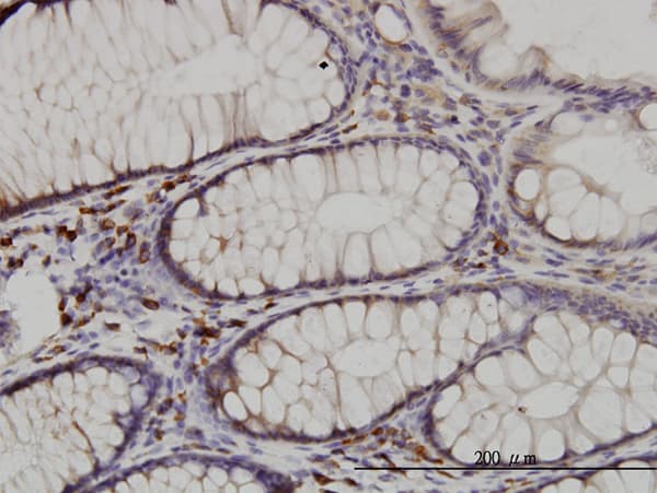 CDK5RAP3 Antibody (clone 1G4)