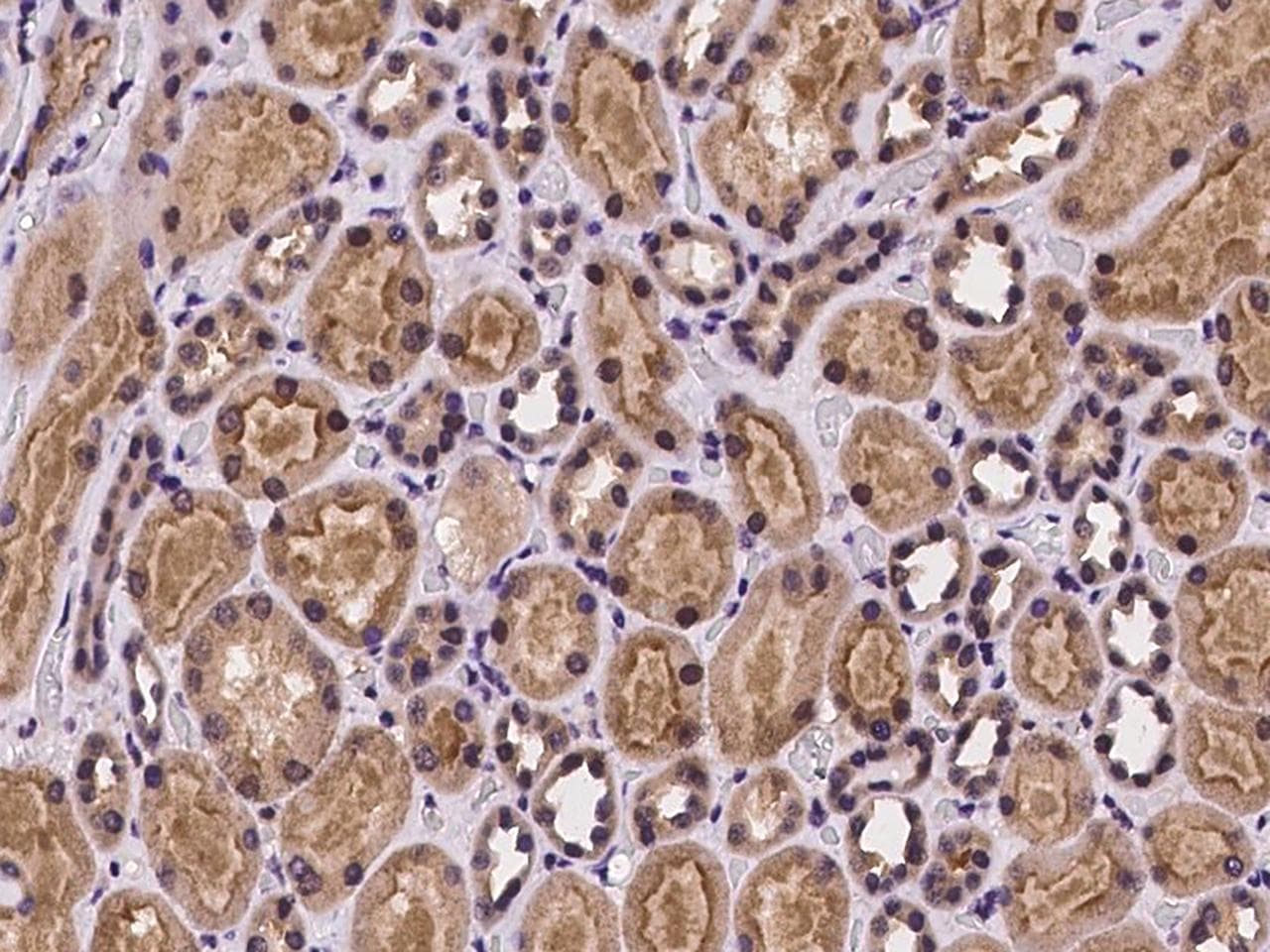 Polyclonal Rabbit anti-Human FLVCR / FLVCR1 Antibody (IHC)