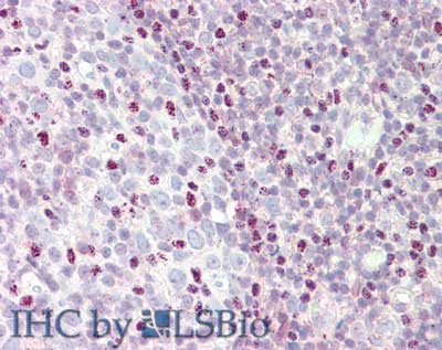 CTCF Antibody (C-Terminus)