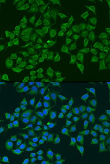 NOS2 / iNOS Antibody