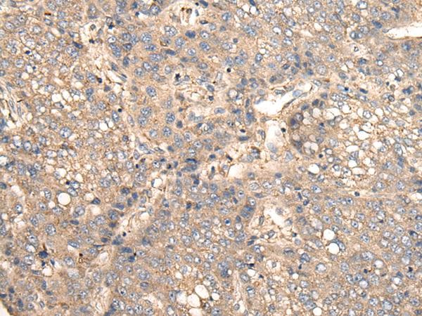 Polyclonal Rabbit anti-Human VTI1B Antibody (IHC, WB)