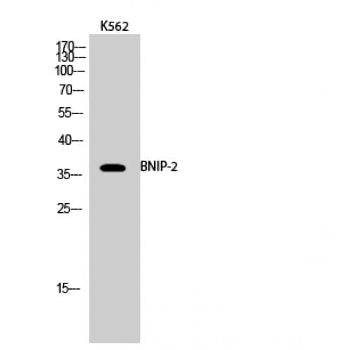 BNIP2 Antibody (Internal)