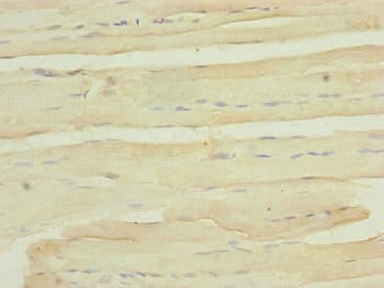 Polyclonal Rabbit anti-Human MYO5B / Myosin VB Antibody (IHC, WB)