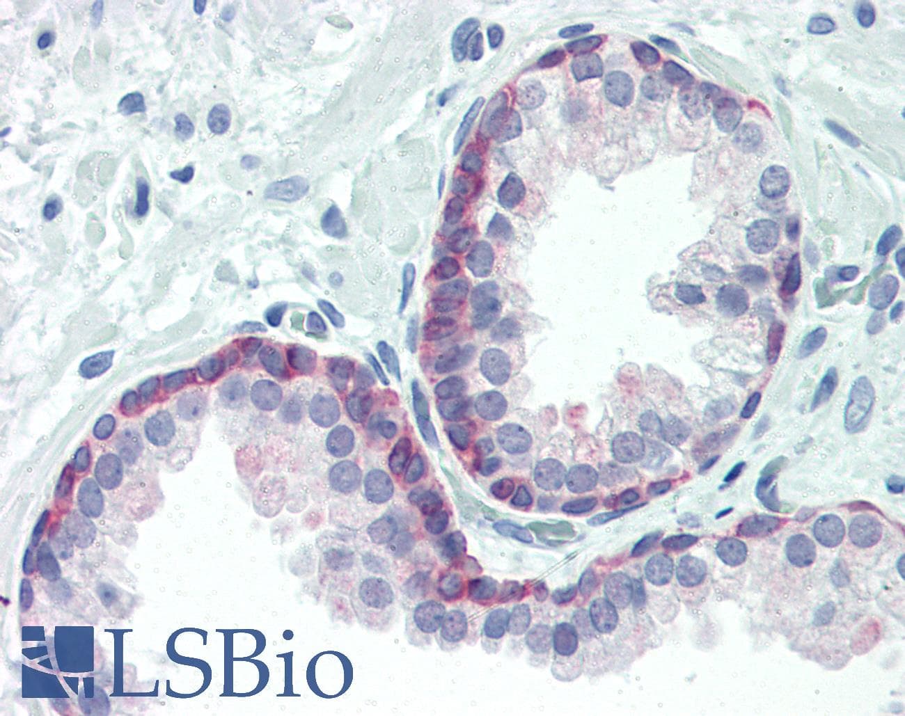 IHC-plus™ FOXO3 / FOXO3A Antibody (phospho-Thr24/Thr32)