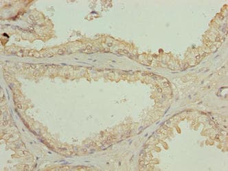 N4BP2L2 Antibody