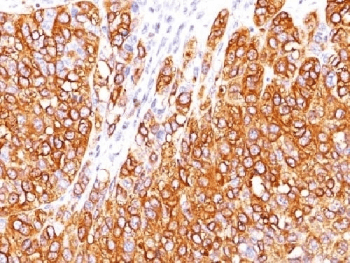 Monoclonal Mouse anti-Human MLANA / Melan-A Antibody (clone M2-7C10, Ready-to-Use, IHC, IF)